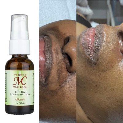 MC® Ultra Brightening Serum is very effective for: dry damaged skin, hyperpigmentation (uneven skin tone) * Natural brighteners * No bleach.