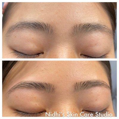 Brow threading before and after