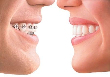 We offer Invisalign!