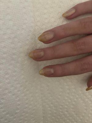 Yellow nails for $45