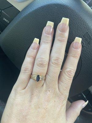 Uneven nails...