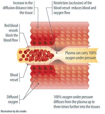 Oxygen saturation under pressure ... even when circulation is restricted!