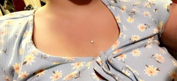 Chest dermal