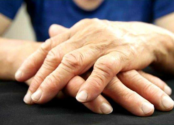 We treat a variety of diagnoses that require Hand Therapy.