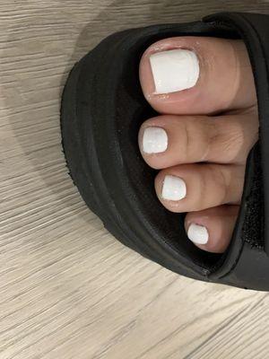 Bad Pedicure