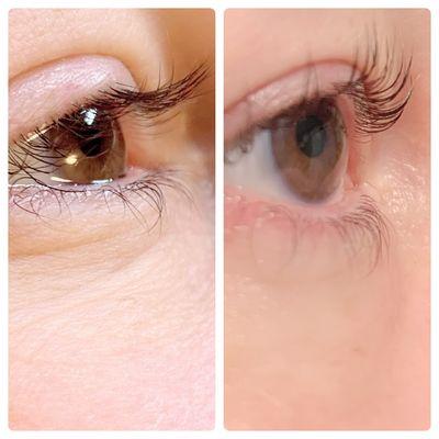 Lash Lift