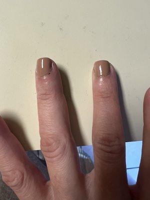 Cut on cuticle