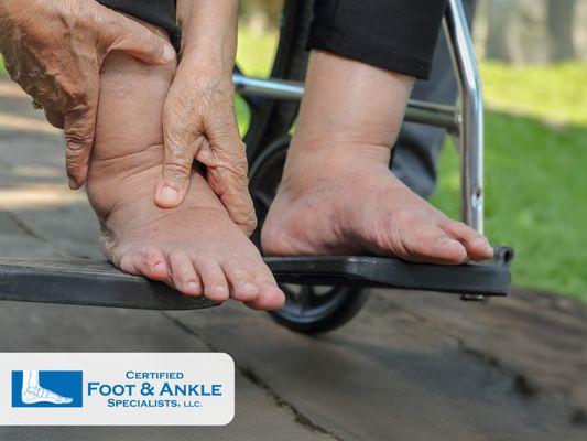 diabetic foot care