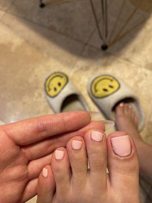 Crooked toenails, dried gel polish everywhere.