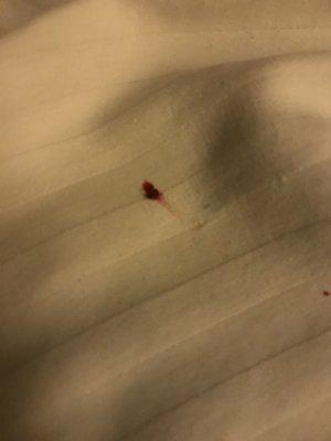 Yet another smashed bed bug