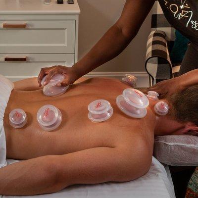 Cupping therapy - NEW!