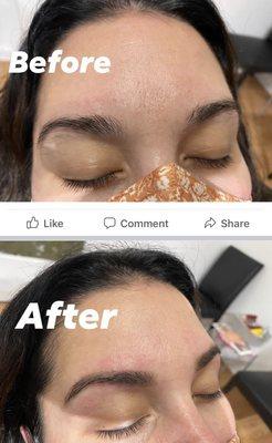 Eyebrow threading