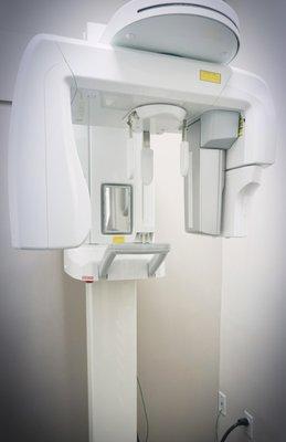 3D CT-scan