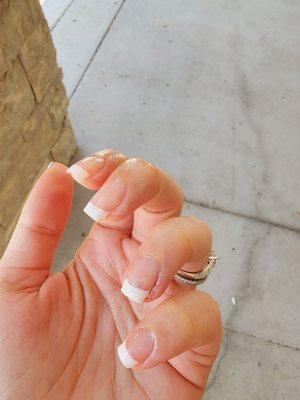 Cut skin, horrible job on nails