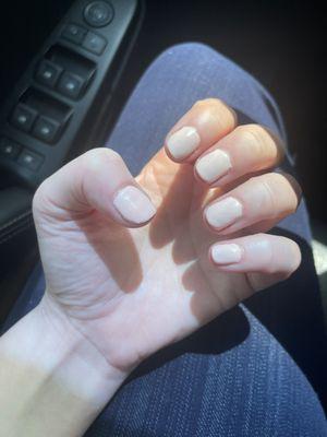 Bad gel nails