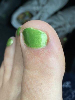 big toe