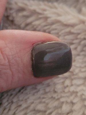 The cuticle...eww and ouch.