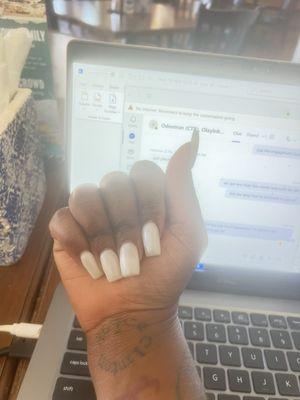 Horrible nails