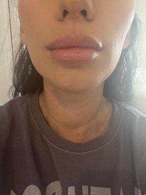 Healed lips