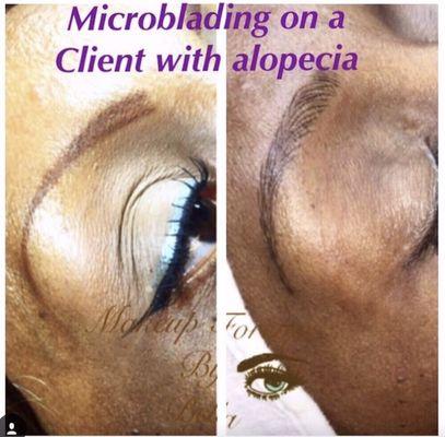 Microblading on a client with alopecia...