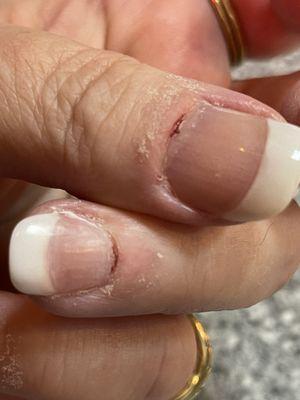 Bleeding cuticles through this EXTREMELY painful manicure.