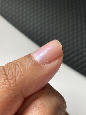 Skin from the nail bed