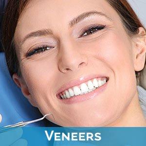 Veneers