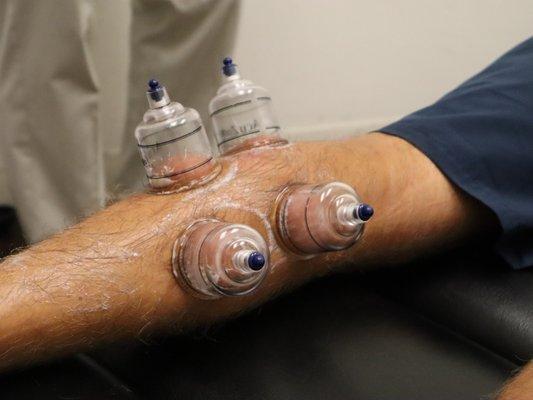 Cupping on Calf