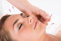 Facial Cosmetic Acupuncture