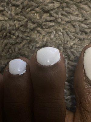 Allegedly a pedicure with fresh gel polish