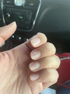 Bad nails