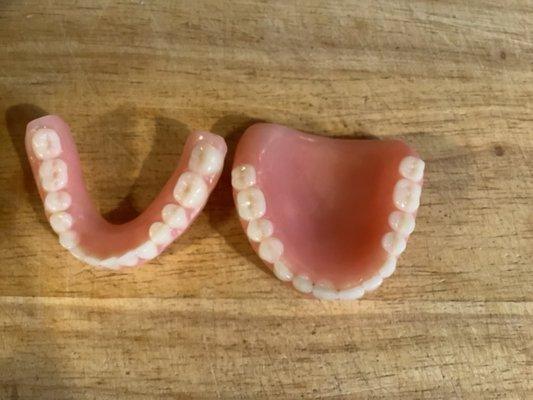 Look at the mis-shaped dentures that was temporary but they never was able to give me a permanent set in 11 months.  Buyer beware