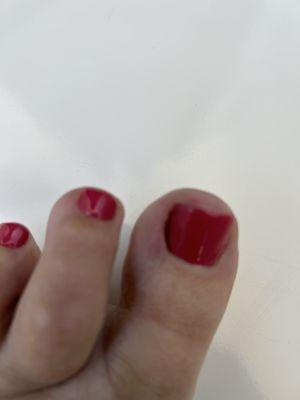 Cut big toe nail