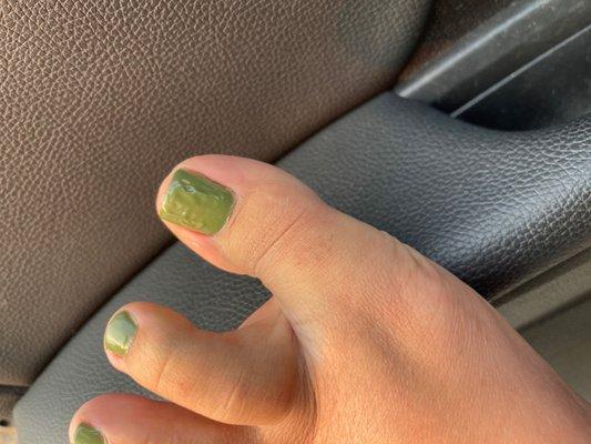 Pedicure disaster