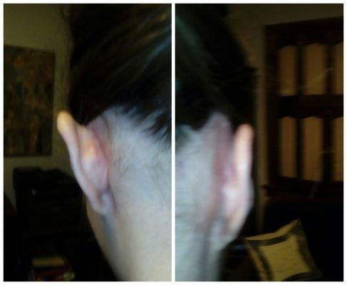 My left ear, which was damaged by Ridenour, compared to my right ear. He made my left ear stick way out.