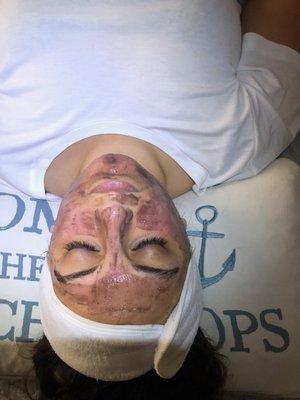 During HydroDermabrasion Facial: Australian Super Berry Antioxidant Mask (Brightening, Hydrating & Anti-Inflammatory Properties)