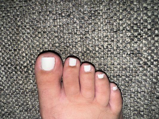 Poor pedicure