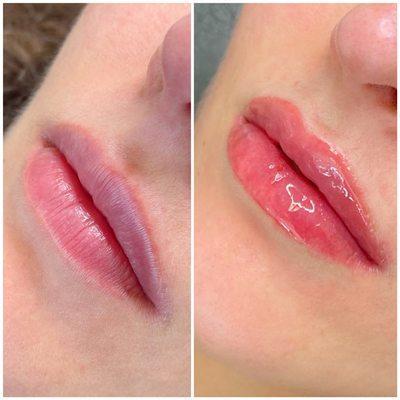 Lip Blush Tattoo (lasts 1-3 years)