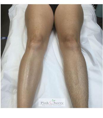 Before (right) and After (left) Full Leg Wax