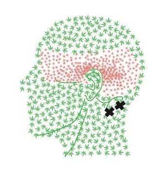 THC trigger point figure