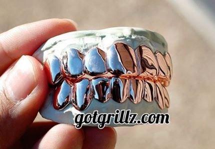 White Gold Grillz