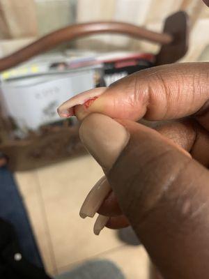 Bloody nail