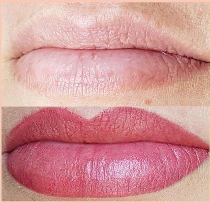 Lip Revitalization