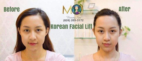 MOI Beauty Spa - beauty spa in El Monte CA 91732