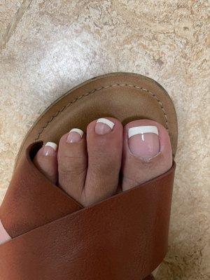 Swollen possibly infected toe