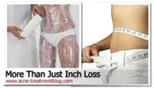 Permanent inch loss, skin tightening and cellulite reduction.