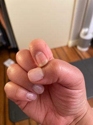 Day 6 and I'm down a nail. Wonder how long the rest will last...