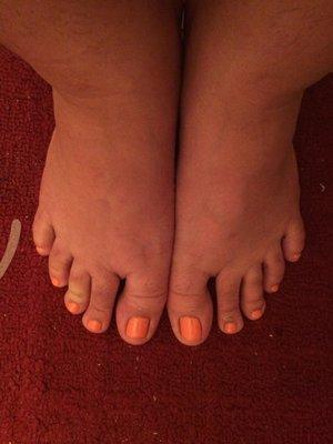 Please excuse my swollen pregger piggies!