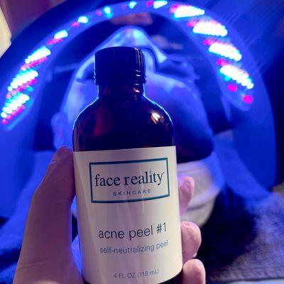 Face Reality treatments for mild and severe acne, clear your skin in 90 days or less!