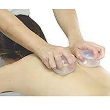 Cupping Therapy